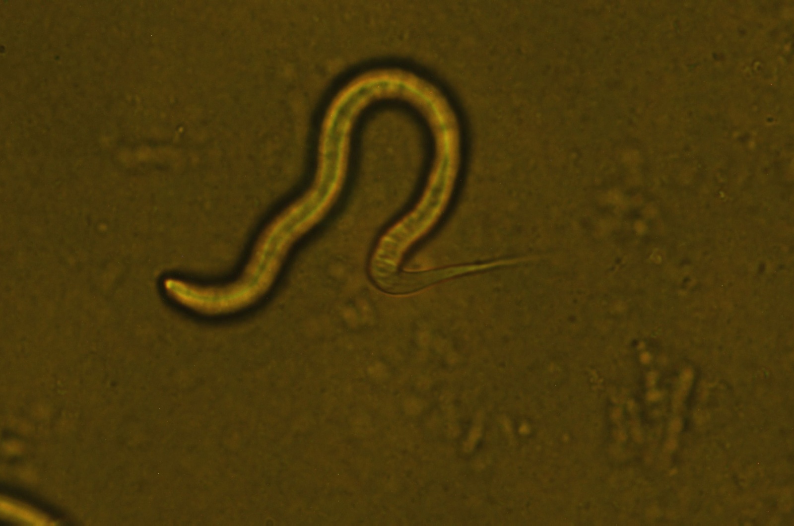 Roundworm