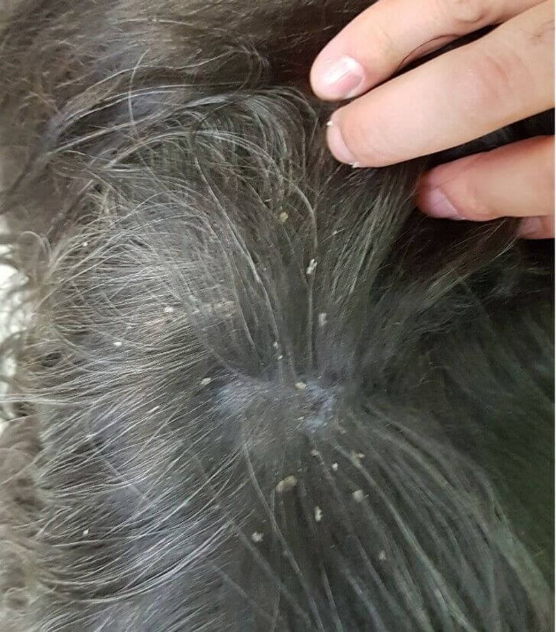 Dry Or Flaky Skin