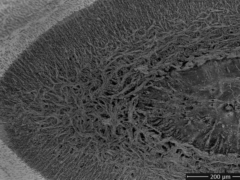 Dentine: The Telltale Tissue