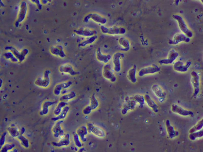 The Unseen Threat: Brain-Eating Amoeba