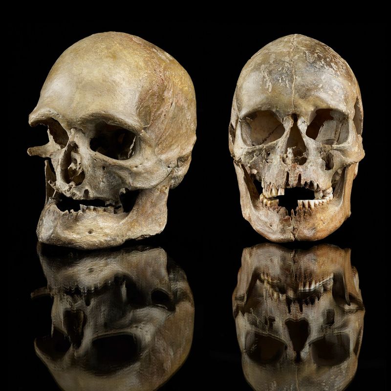 Unexplained Longevity Genes