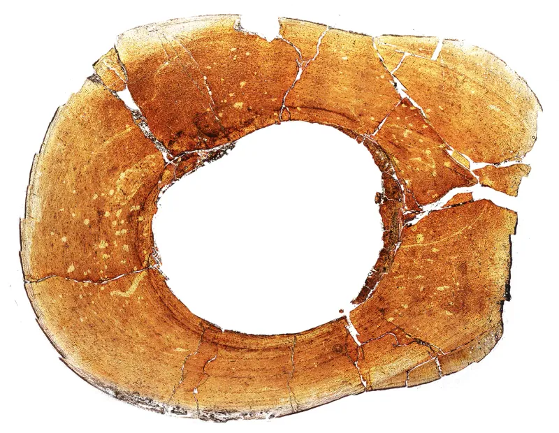 Growth Rings Tell Life History