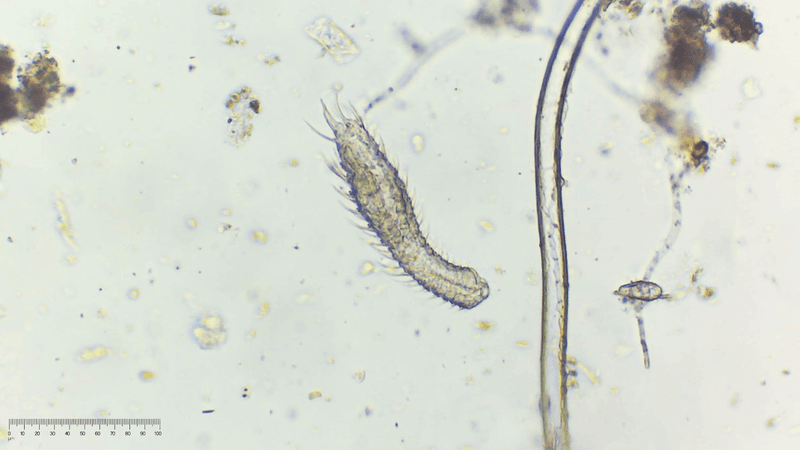 Gastrotrich – Microscopic And Short-Lived