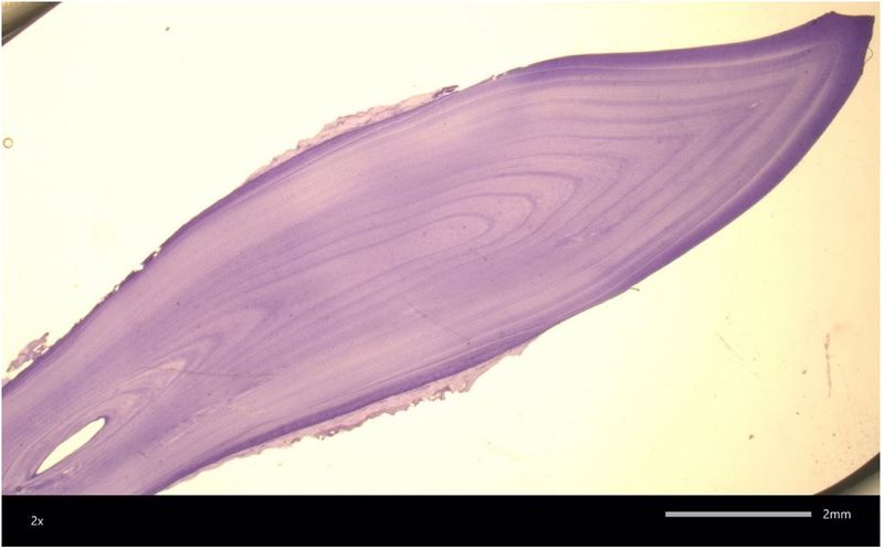 Growth Rings Like Trees