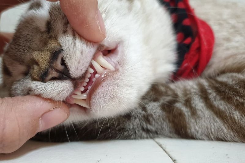 Teeth And Dental Development