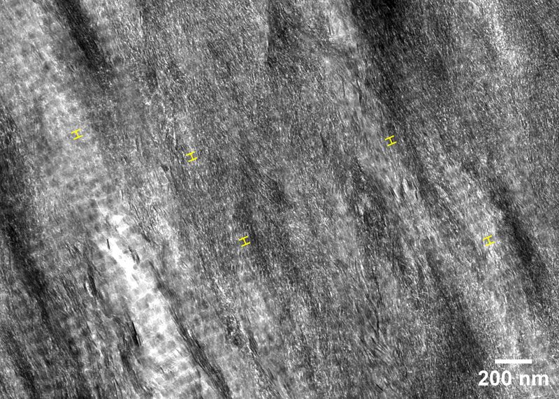 Tiny Crystal Alignments Strengthen the Skeleton