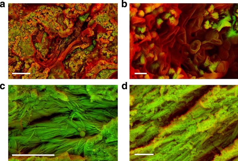 Microbial Decay Was Cut Off Midway