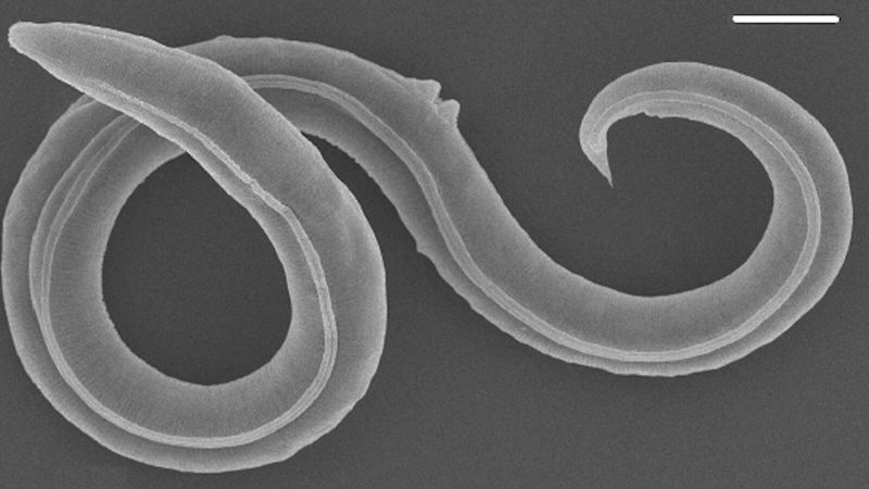 The Worm Was In A Suspended State Called Cryptobiosis